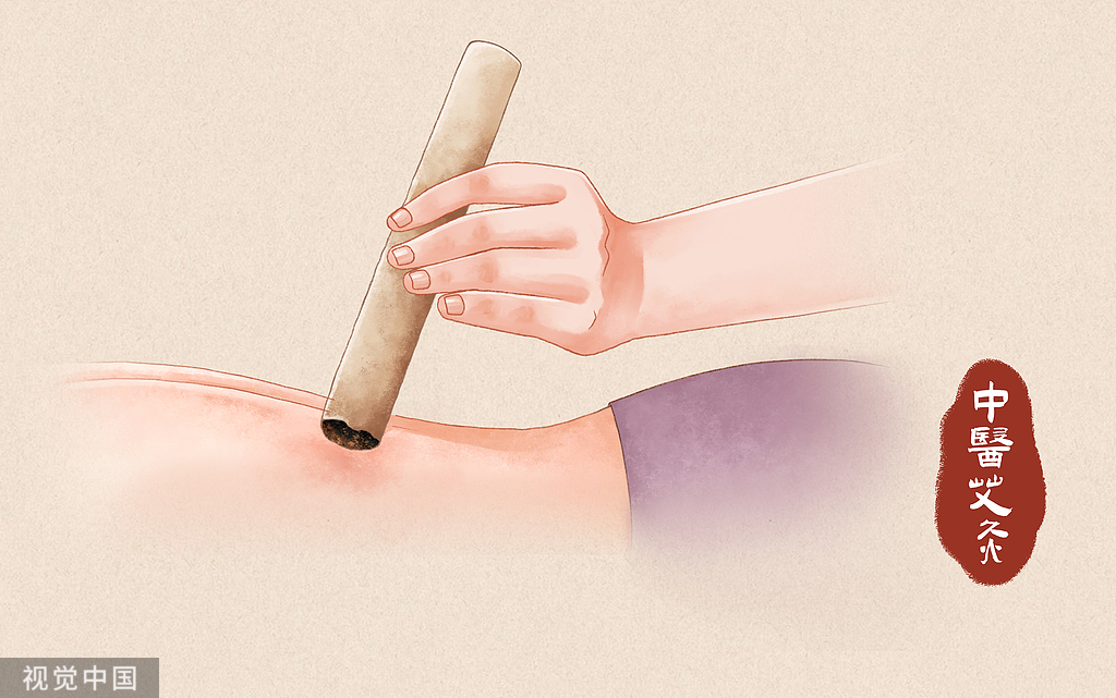 艾灸工具与材料